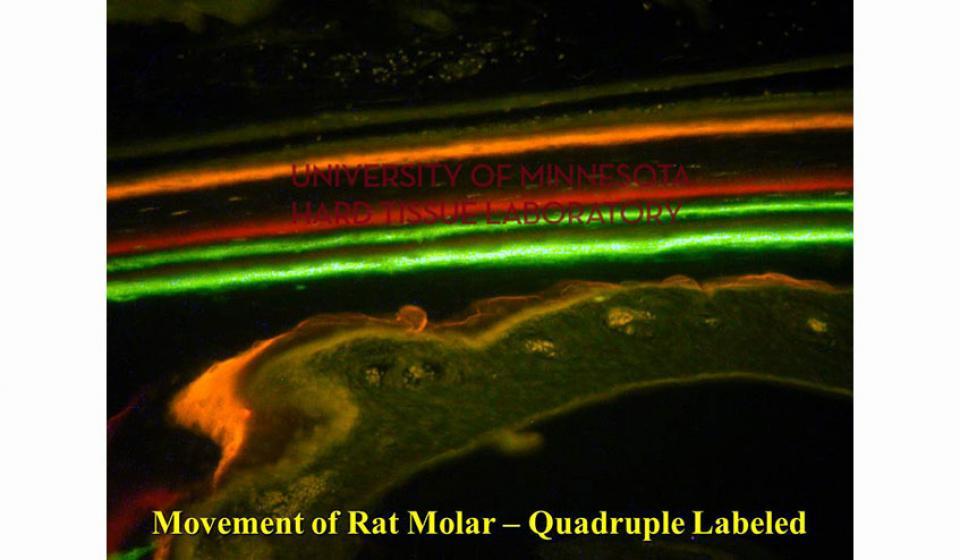 Movement of Rat Molar - Quadruple Labeled