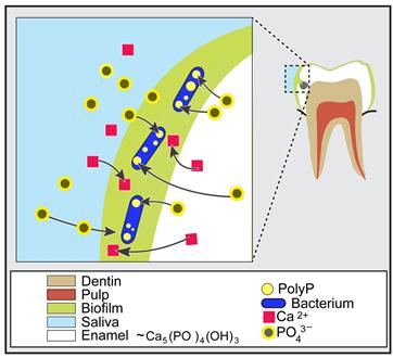 Tooth Decay Model